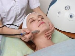 Face laser rejuvenation