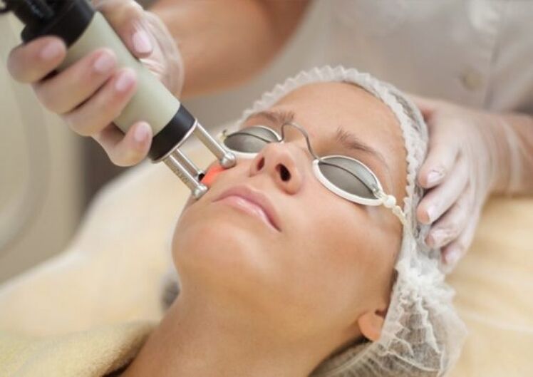 Laser rejuvenation procedure on the field