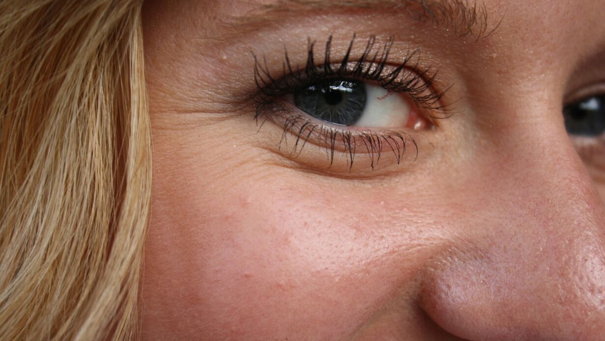 The appearance of wrinkles is a natural process