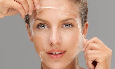 Deep peeling improves the skin's regeneration processes, rejuvenating it